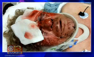 Illustration for article titled Teen Charged With Attempted Murder After Brutal Beating of Md. Man
